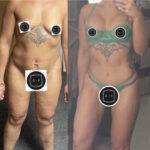 mummy makeover uk before and after 2 pictures