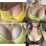 boob job before and after