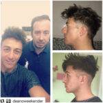 nose job before and after on a celebrity