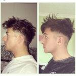 nose job before Ana after of a man two images