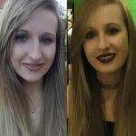 a young woman showing her nose job before and after