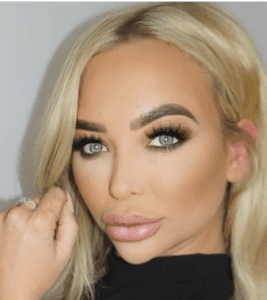 rhinoplasty cost London results uk