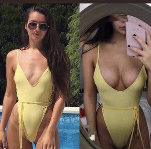 boob job before and after