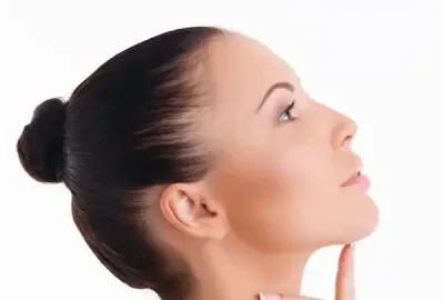 Bulbous Tip Rhinoplasty